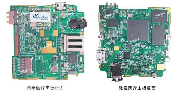 杭州迅得電子 | 微泰醫療設備主板組裝 | 可穿戴醫療設備電路板組裝服務